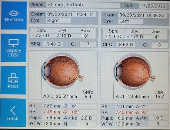 The OCULUS Myopia Master Simplifies and Improves Myopia Management - Review of Myopia Management
