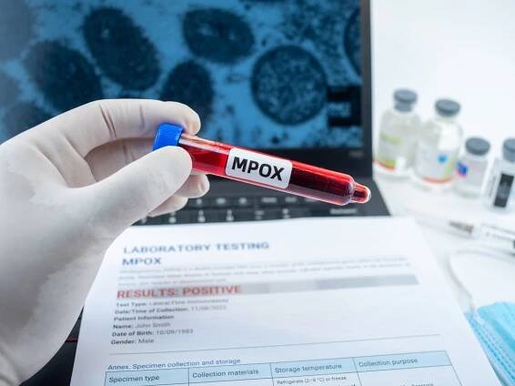 Mpox outbreak: How can UK travellers stay safe from the virus?