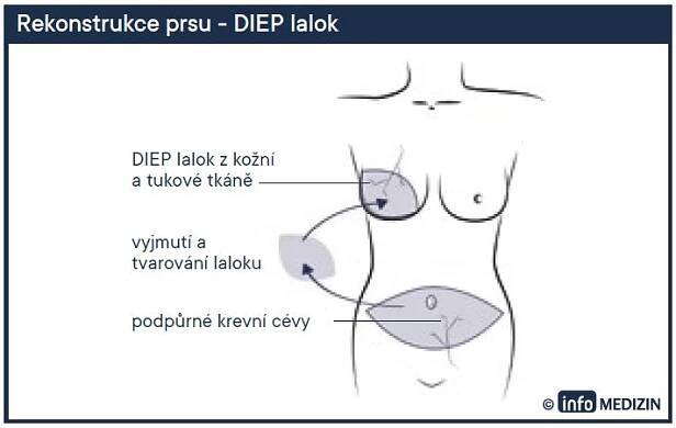 rekonstrukce-3