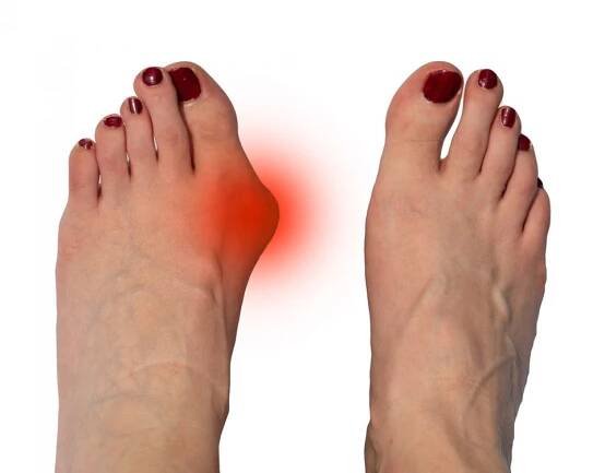 News | Palmetto State Podiatry | (843) 773-6246 | Click Here