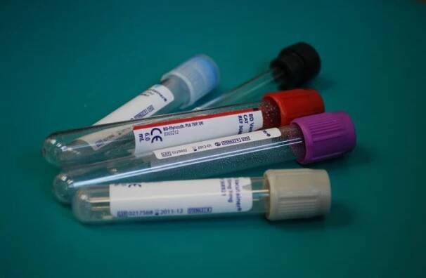 Thyreoglobulin
