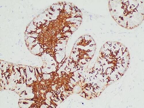 Cytokeratin 5/6 antibodies - Wikipedia