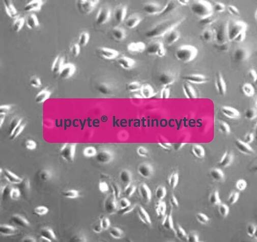 Upcyte