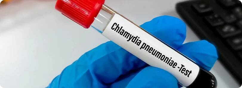 Plicní chlamydie: nakažlivost, příznaky a léčba | BENU.cz 