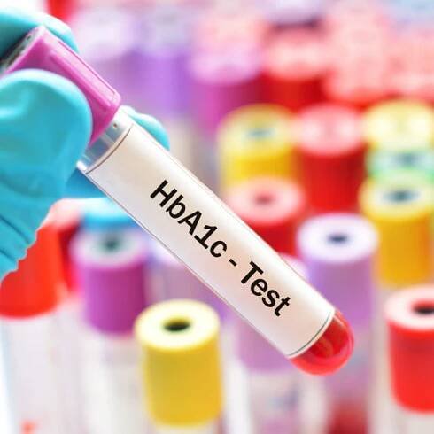 Rozumíte svému lékaři? Co znamená, když se řekne „glykovaný hemoglobin“