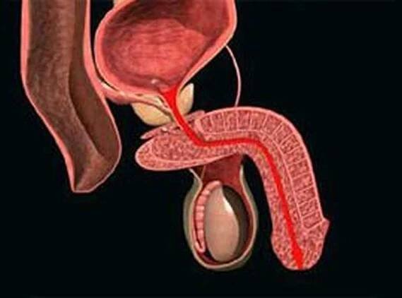 Symptomy chronické prostatitidy, diagnostika a léčba / Prostatitida