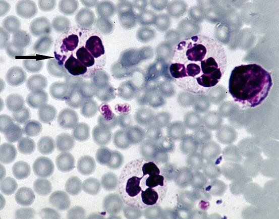 Soubor:Anaplasma-phagocytophilum-sheep.jpg – Wikipedie
