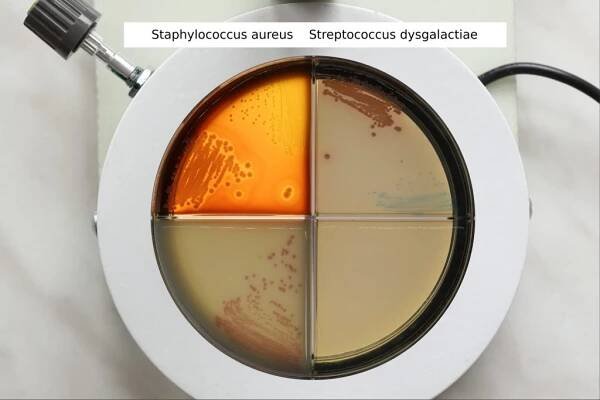 Staphylococcus aureus