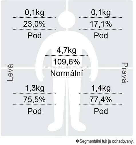 Interpretace - InBody