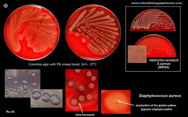 Staphylococcus aureus bacteria
