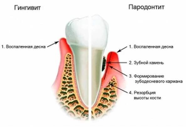 Příčiny onemocnění žaludku, příznaky, léčba / Články | Užitečné informace a tipy na péči o sebe. Zdraví, výživa a další.
