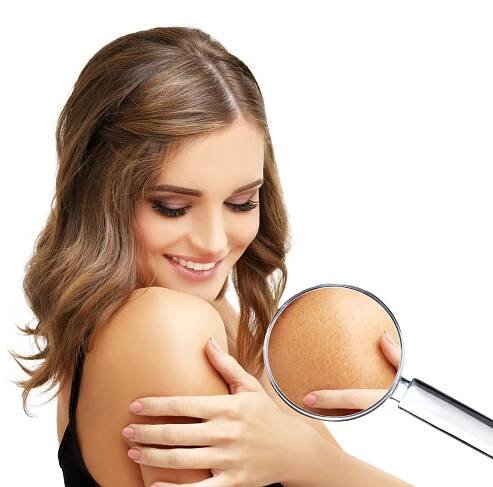 Solution Dark Body Areas: Bleaching Body Parts