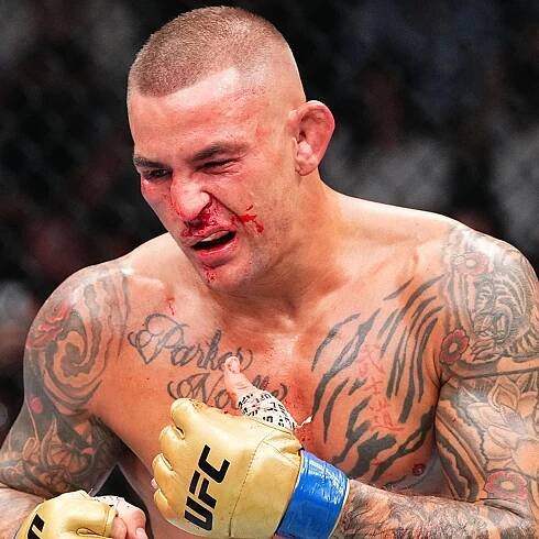 Dustin Poirier Says He Suffered Broken Nose, Rib During UFC 302 Fight