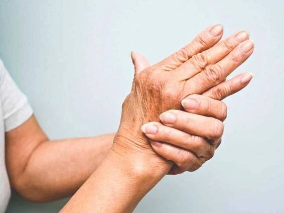 Psoriatic Arthritis