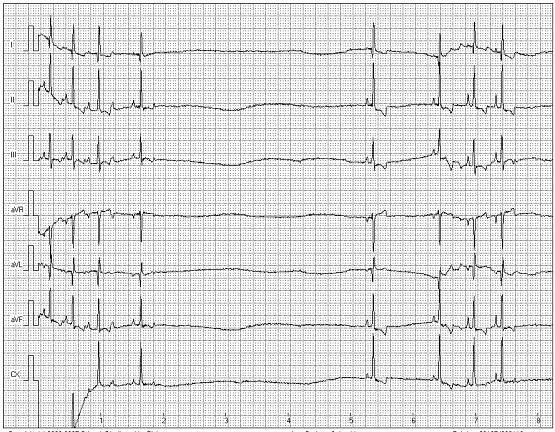 EKG – Elektrokardiogramm - Tierarztpraxis Dr. med. vet. Ingo Schneider