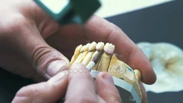 Zubní technik, použití keramické glazury na obsazení s dentální Cnc stroj — Stock záběr