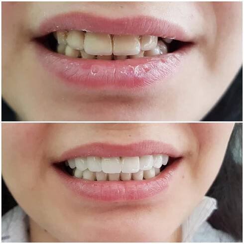 DENTAL TREATMENTS | North Health Group