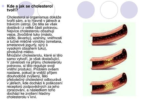 PPT - ZVÝŠENA HLADINA CHOLESTEROLU PowerPoint Presentation, free download - ID:6171047