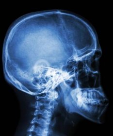 filmový rentgenový pohled na lebku a krční páteř - rejnok rejnoci - stock snímky, obrázky a fotky