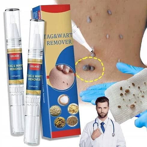 Řešení pro odstraňování bradavic propiska pro odstraňování bradavic Bezbolestné