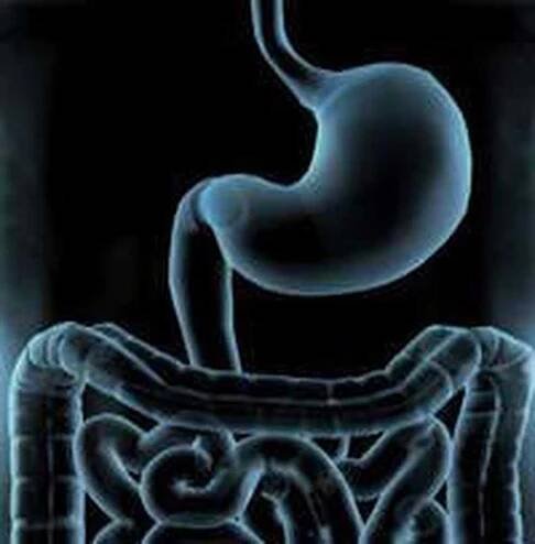 Volvulus / Volvulus