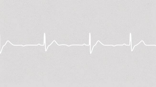 A Change of Heart