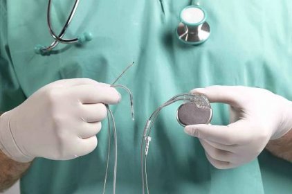 What Is a Pacemaker and How Does It Work?