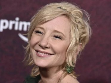 Anne Heche’s death ruled accidental after fiery car crash