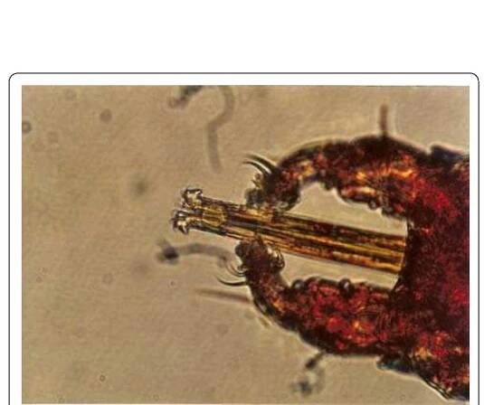 Figure 44 Chelicerae of Trombiculid mite (Geckobia sp.) in Tokay Gecko (Gekko gecko). 