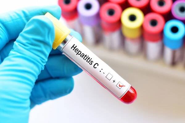 How to Prevent Hepatitis C: Hardeep M. Singh, M.D.: Gastroenterologist
