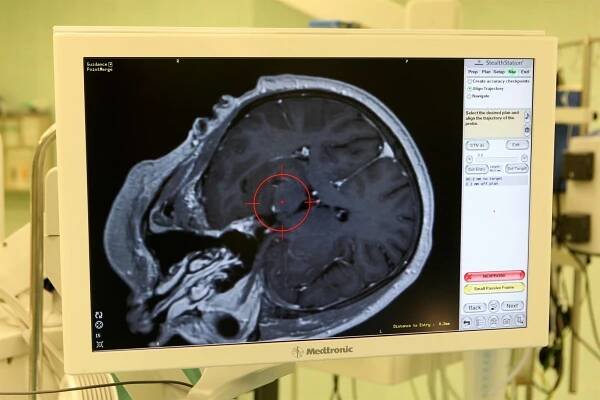 Centra pro léčbu Parkinsona chybí, speciální léčbu dostanou dva lidé ze sta