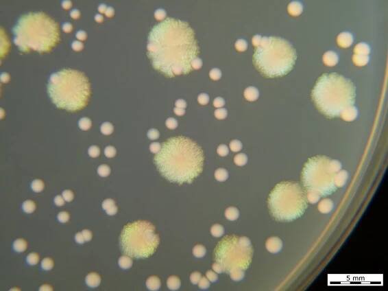 Bacteria images and photos by Hans Newman on Wikipedia and Wikimedia Commons.