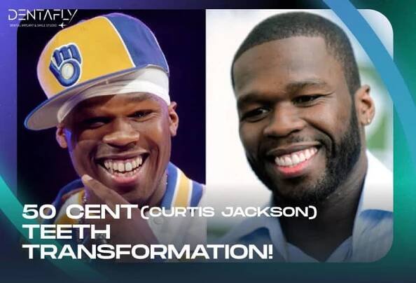50 Cent Curtis Jackson Teeth Transformations