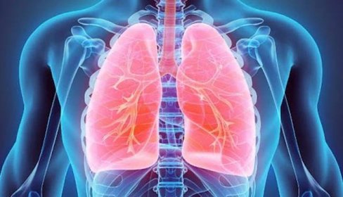 Klinický přehled: syndrom akutní respirační tísně (ARDS)