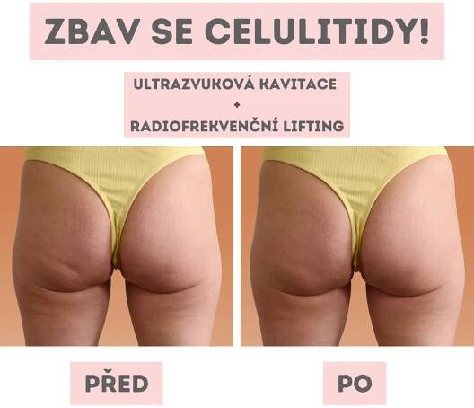 Laser estetické centrum - Klatovy