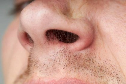 Co riskujete, když si odstraníte chloupky z nosu. Nemoci, kterým jste vystaveni