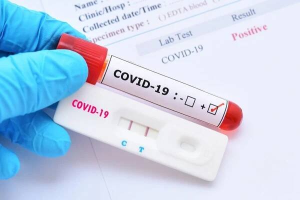 Mimořádná a ochranná opatření - s ohledem na zřušení stavu pandemické pohotovosti od 5.5.2022 zaniká nárok na jeden preventivní PCR test měsíčně zdarma | Kurzy.cz