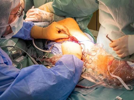 Cévní chirurg připraví tepnu nohy pro bypass operaci — Stock obrázek