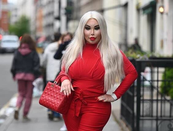 Transgender celebrita Jessica Alves se vyjedla na 102 kilogramů. Její hubnoucí plán mnozí nechápou – Stories.cz