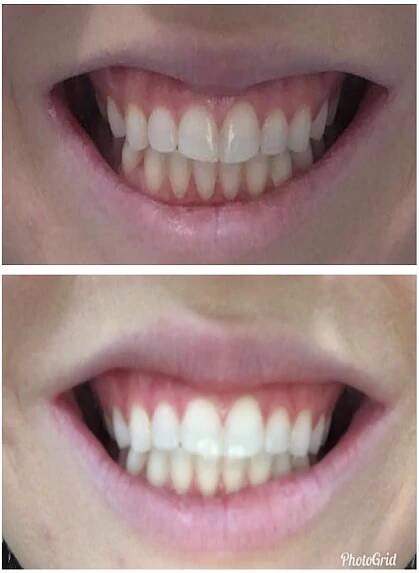 teeth