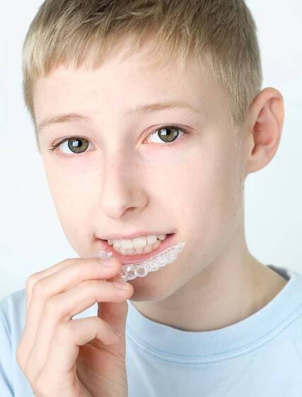 Aligners [Invisalign]