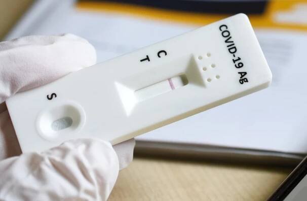 i60.cz: Končí bezplatné testy na covid-19. Stát bude hradit pouze preventivní testy osobám do věku 18 let