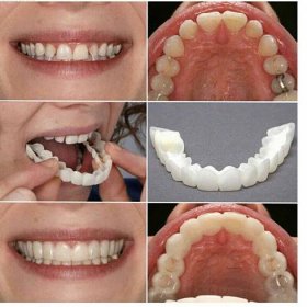 Falešné zuby horní + dolní zubní dýhy zubní protézy Sada krytu zubů