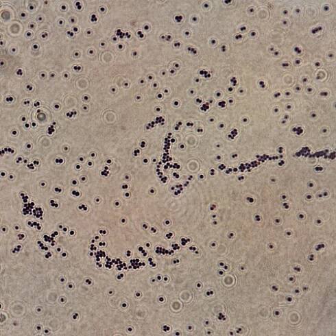 Staphylococcus saprophyticus - Wikipedia