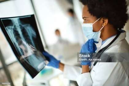 Lékař analyzuje rentgenový snímek pacienta s COVID-19. - Bez autorských poplatků Rentgenový snímek - Vědeckou zobrazovací techniku Stock fotka