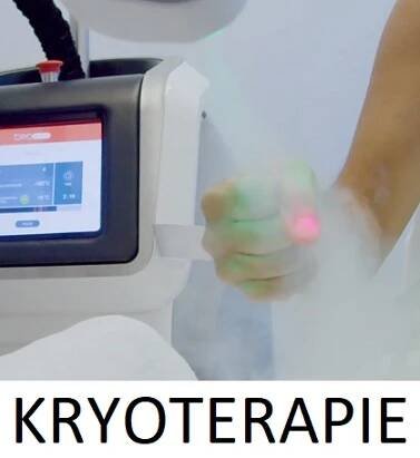 Kryoterapie pro léčbu artritidy – vše, co potřebujete vědět