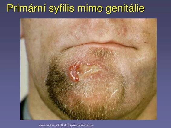 PPT - Lékařská mikrobiologie pro ZDRL PowerPoint Presentation, free download - ID:3576725