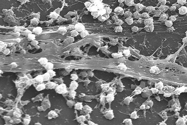 Biofilm – WikiSkripta