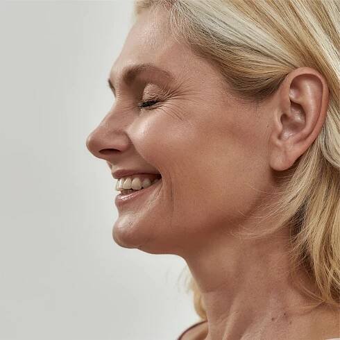 Morpheus8 Miami | Advanced RF Microneedling | Simple Aesthetics