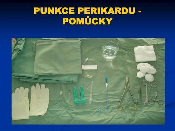 PPT - PERIKARDIÁLNÍ PUNKCE PowerPoint Presentation, free download - ID:3628766